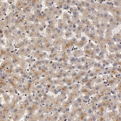 Butyrylcholinesterase/BCHE Antibody, Novus Biologicals:Antibodies:Primary
